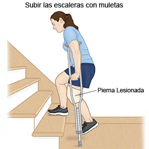 subir escaleras-edigar
